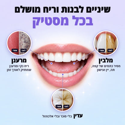SmileyGum - מסטיקים פרימיום לחיוך בריא